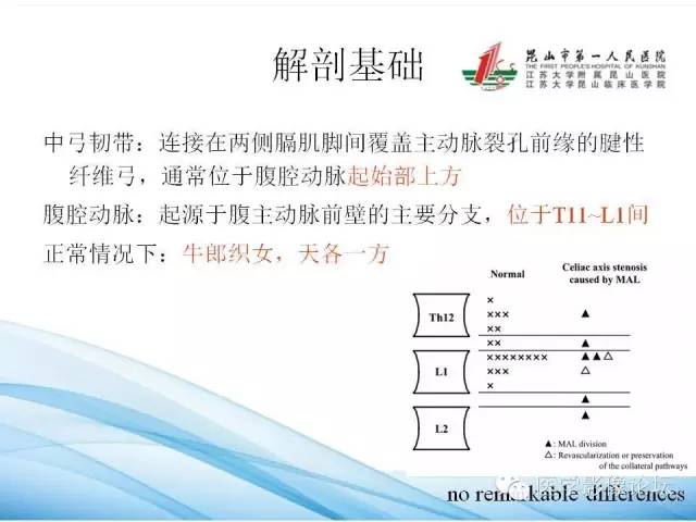 【PPT】正中弓状韧带致腹腔动脉压迫综合征CTA表现 【PPT】正中弓状韧带致腹腔动脉压迫综合征CTA表现