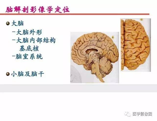 【PPT】脑梗塞影像学诊断