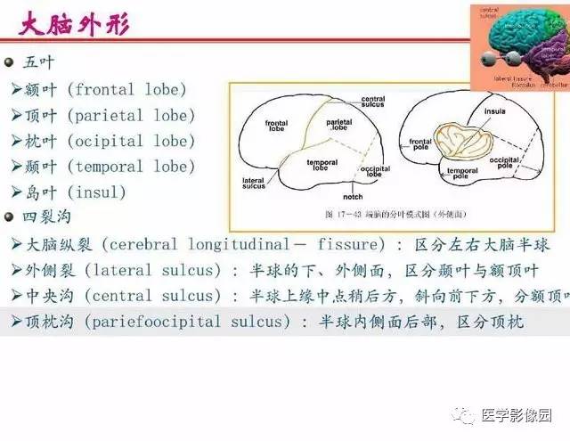 【PPT】脑梗塞影像学诊断