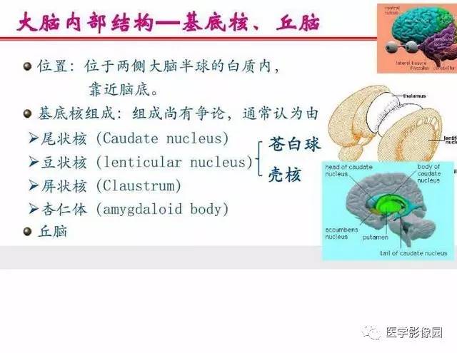 【PPT】脑梗塞影像学诊断