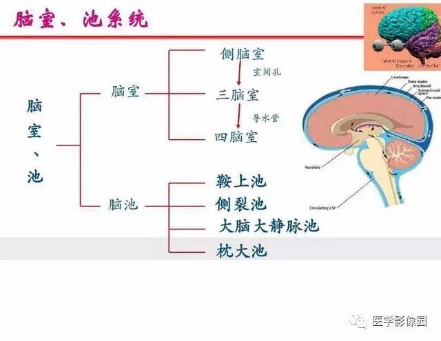 【PPT】脑梗塞影像学诊断