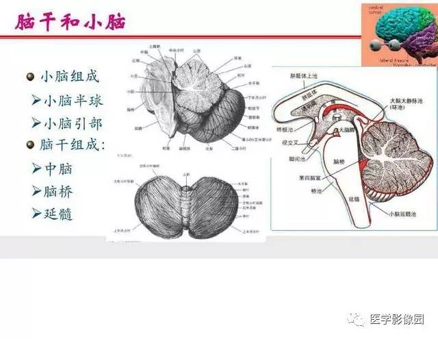 【PPT】脑梗塞影像学诊断