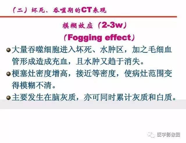 【PPT】脑梗塞影像学诊断