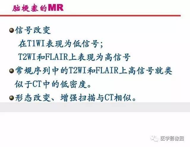 【PPT】脑梗塞影像学诊断