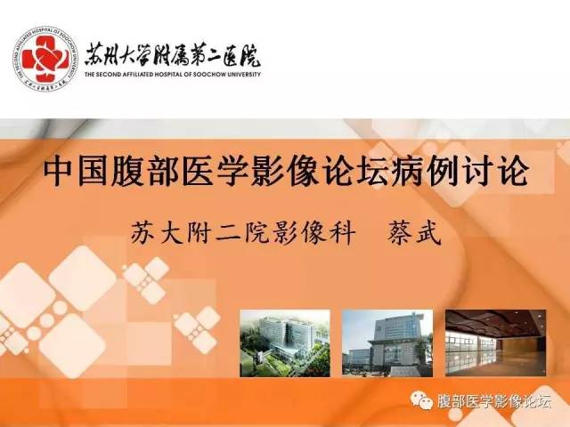 【病例】膀胱神经纤维瘤1例CT影像表现