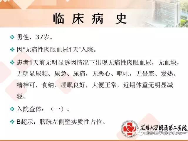 【病例】膀胱神经纤维瘤1例CT影像表现