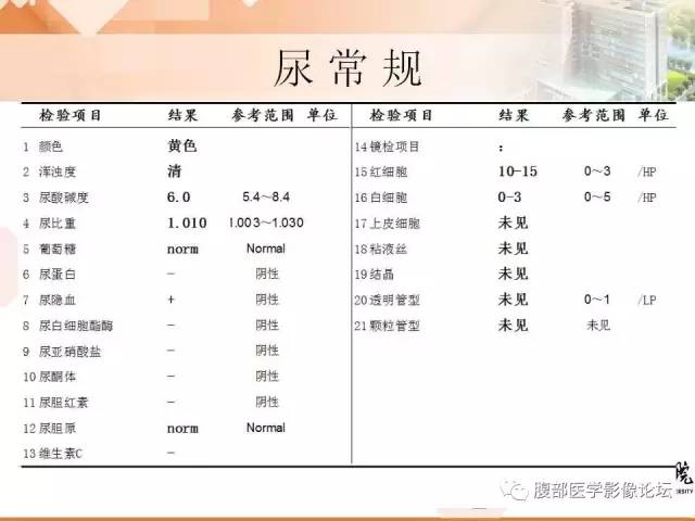 【病例】膀胱神经纤维瘤1例CT影像表现