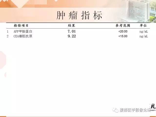 【病例】膀胱神经纤维瘤1例CT影像表现