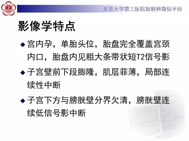 【病例】胎盘植入1例MR影像表现