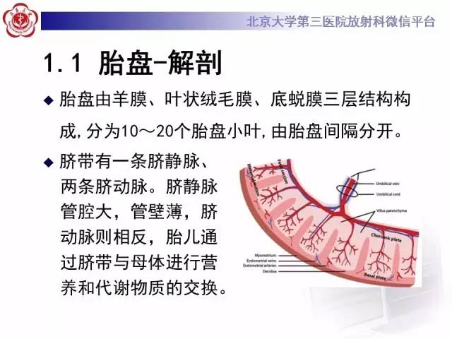 【病例】胎盘植入1例MR影像表现