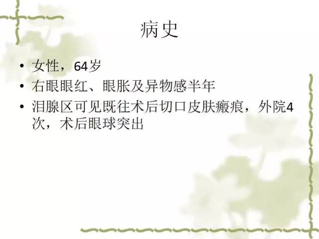 【病例】泪腺多形性腺癌1例MR影像表现