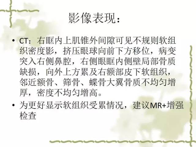 【病例】泪腺多形性腺癌1例MR影像表现