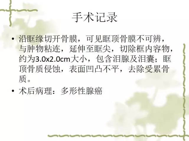 【病例】泪腺多形性腺癌1例MR影像表现