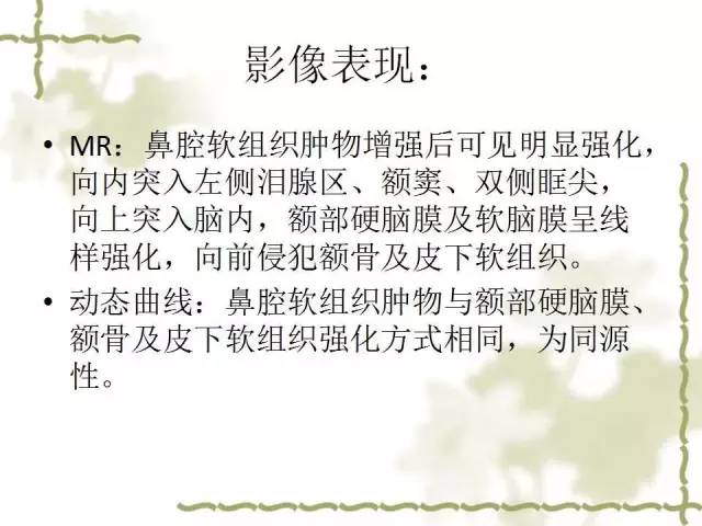 【病例】泪腺多形性腺癌1例MR影像表现