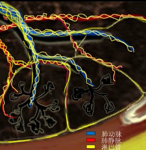 磨玻璃影?警惕9大感染性疾病 磨玻璃影?警惕9大感染性疾病
