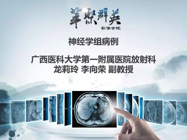 【病例】颅内孤立性纤维瘤1例MR影像表现与鉴别