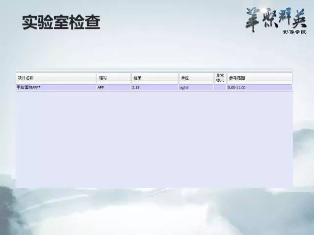 【病例】颅内孤立性纤维瘤1例MR影像表现与鉴别
