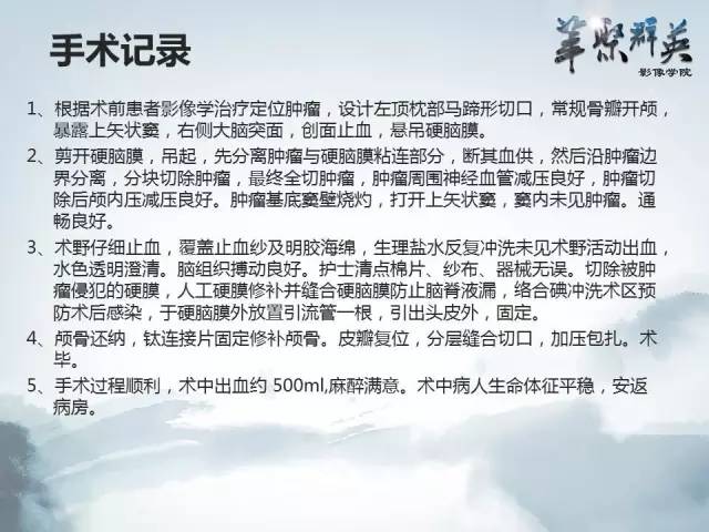 【病例】颅内孤立性纤维瘤1例MR影像表现与鉴别