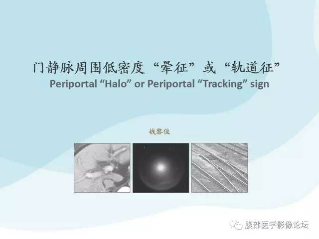 【PPT】门静脉周围低密度“晕征”或“轨道征”
