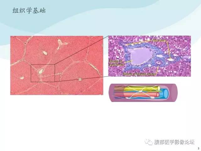【PPT】门静脉周围低密度“晕征”或“轨道征”
