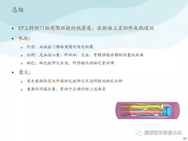【PPT】门静脉周围低密度“晕征”或“轨道征”