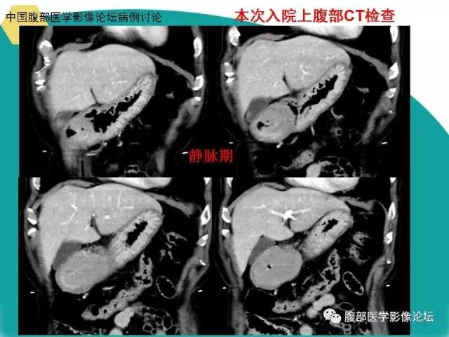 自动草稿