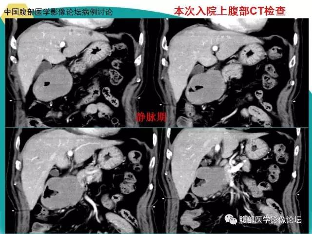 自动草稿