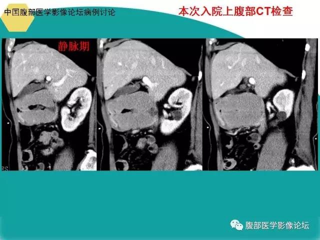 自动草稿