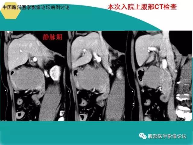 自动草稿