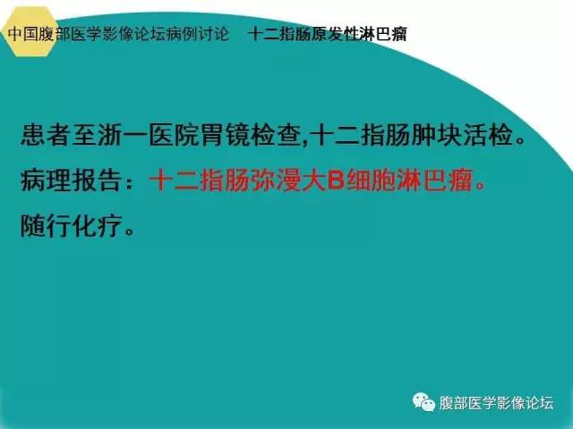 自动草稿