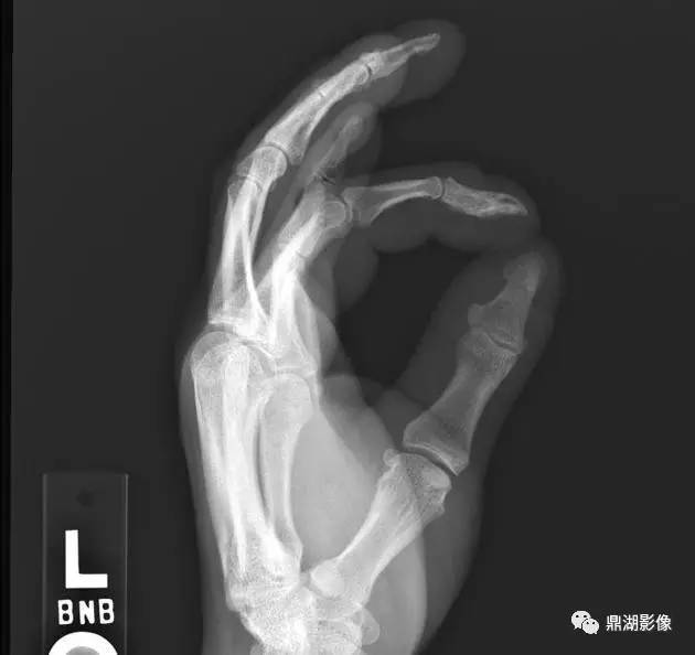 手足骨常见疾病的鉴别诊断