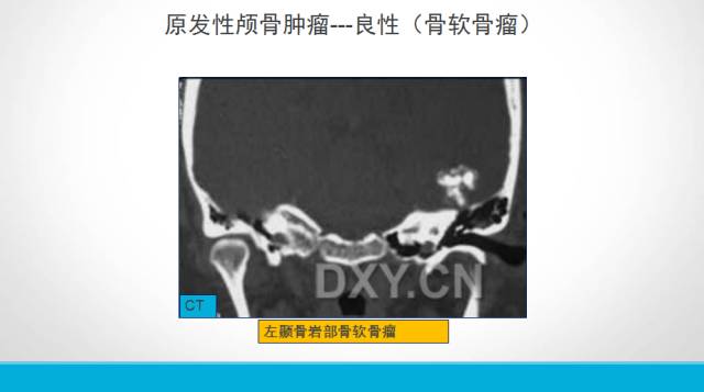 【PPT】颅骨肿瘤及肿瘤性病变影像学详解