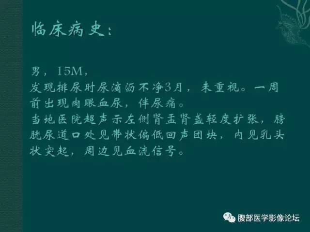 【病例】膀胱胚胎性横纹肌肉瘤1例CT影像表现