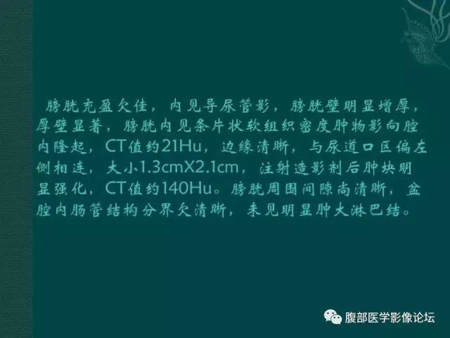 【病例】膀胱胚胎性横纹肌肉瘤1例CT影像表现