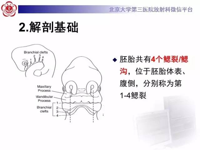 【病例】鳃裂囊肿伴感染1例CT影像表现