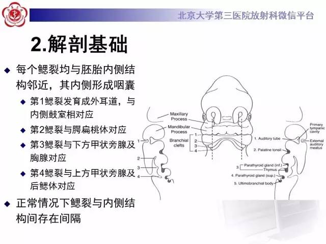【病例】鳃裂囊肿伴感染1例CT影像表现