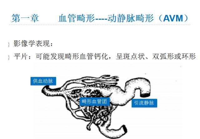 【PPT】颅脑血管性疾病影像学