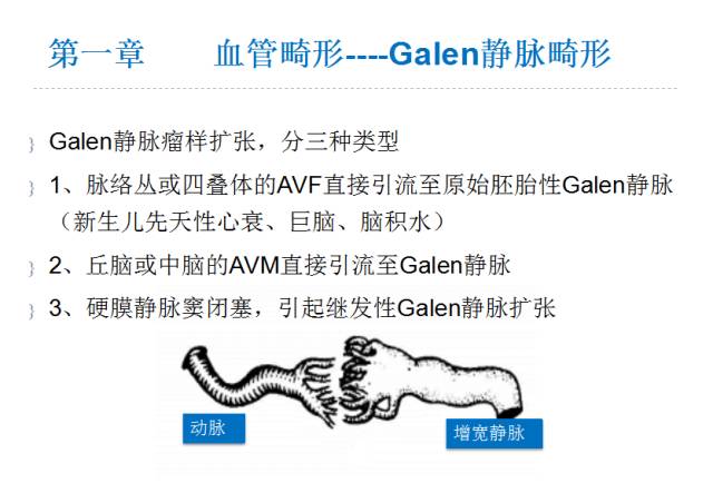 【PPT】颅脑血管性疾病影像学