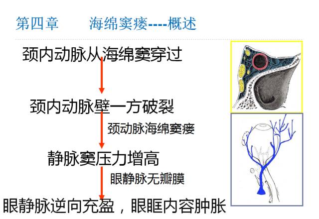 【PPT】颅脑血管性疾病影像学
