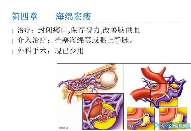 【PPT】颅脑血管性疾病影像学