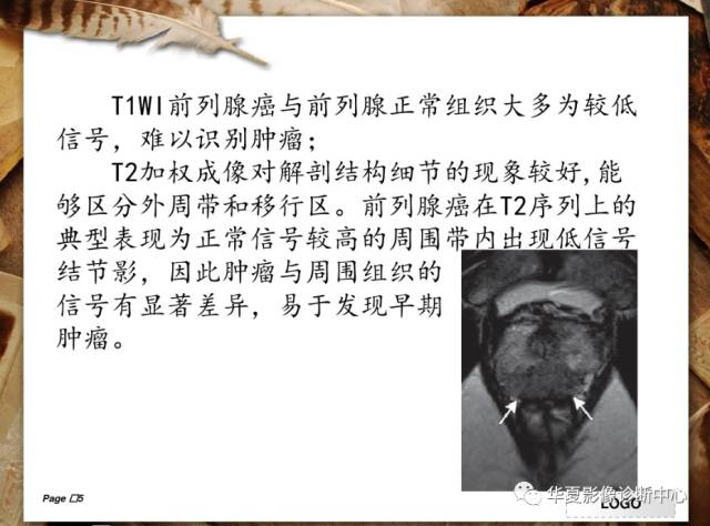 【PPT】