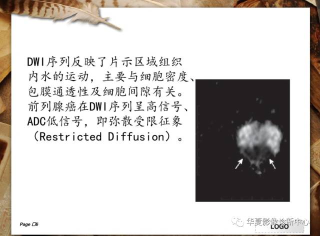 【PPT】