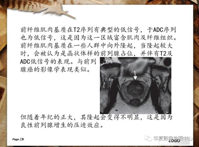 【PPT】