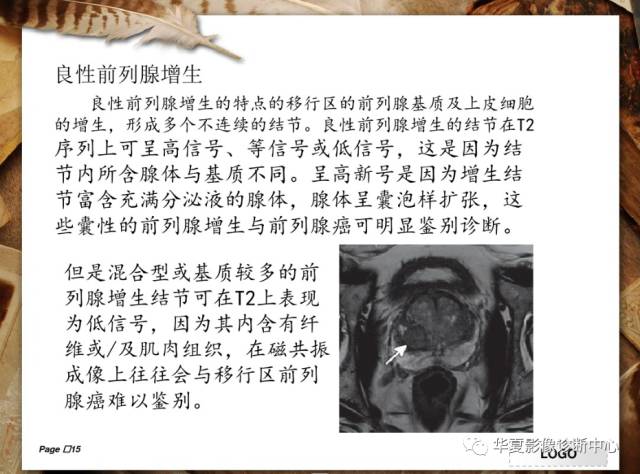【PPT】