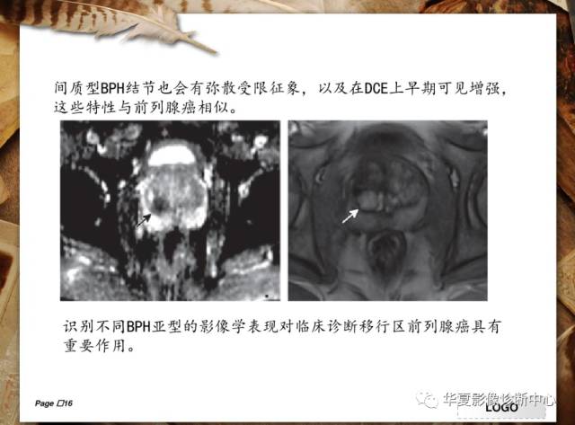 【PPT】