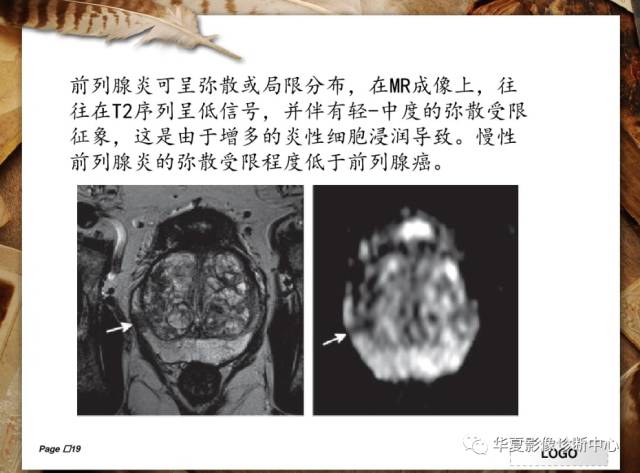 【PPT】