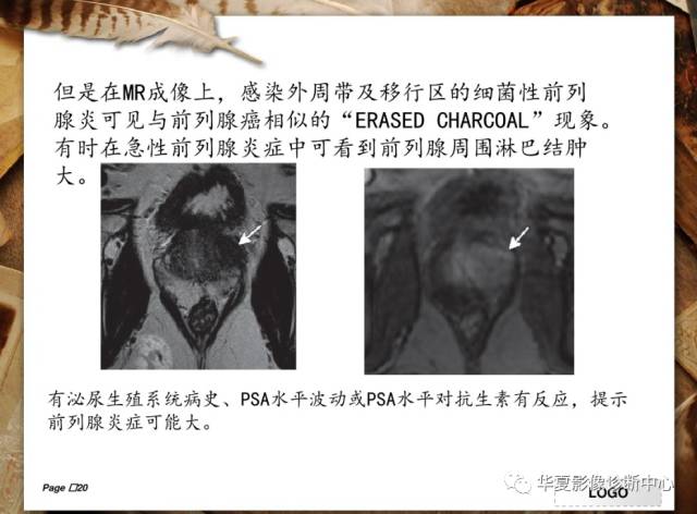 【PPT】
