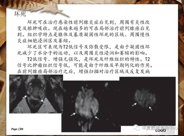 【PPT】
