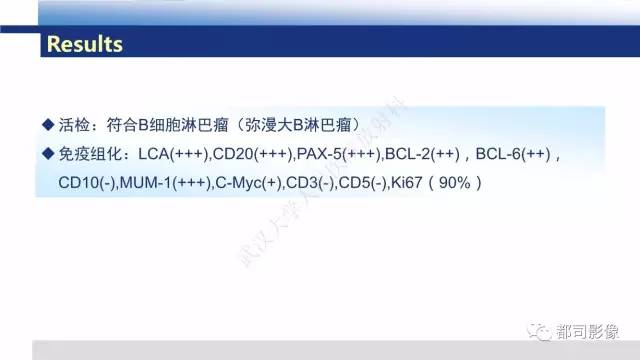 【PPT】原发性中枢神经系统淋巴瘤影像诊断