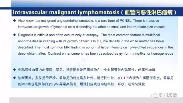 【PPT】原发性中枢神经系统淋巴瘤影像诊断
